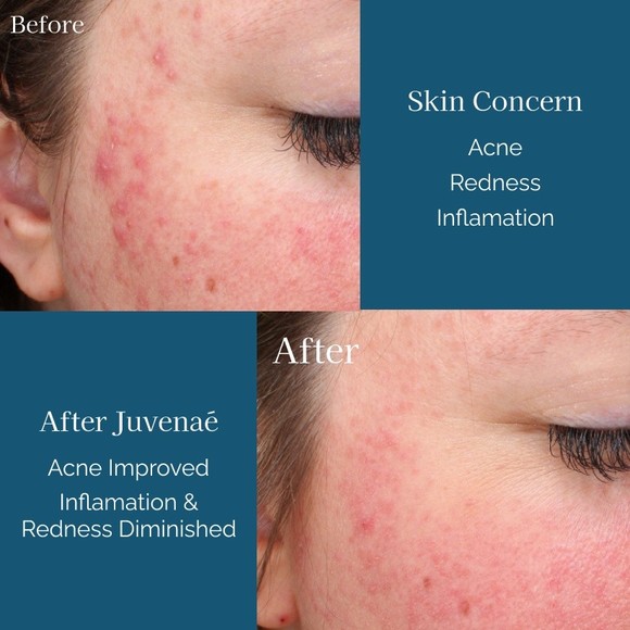 Juvenae Skincare Anti Aging Cream Moisturizer Wrinkles Sunspot Tightness New $60 - Picture 7 of 7